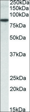 Anti-TRIM36 (C-terminal) antibody produced in goat affinity isolated antibody, buffered aqueous solution