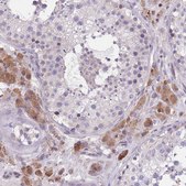 Anti-WWOX antibody produced in rabbit Prestige Antibodies® Powered by Atlas Antibodies, affinity isolated antibody, buffered aqueous glycerol solution