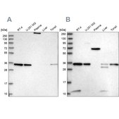 Anti-VPS37B antibody produced in rabbit Prestige Antibodies® Powered by Atlas Antibodies, affinity isolated antibody, buffered aqueous glycerol solution