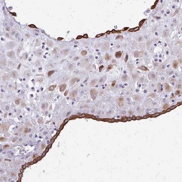 Anti-EPYC antibody produced in rabbit Prestige Antibodies&#174; Powered by Atlas Antibodies, affinity isolated antibody, buffered aqueous glycerol solution