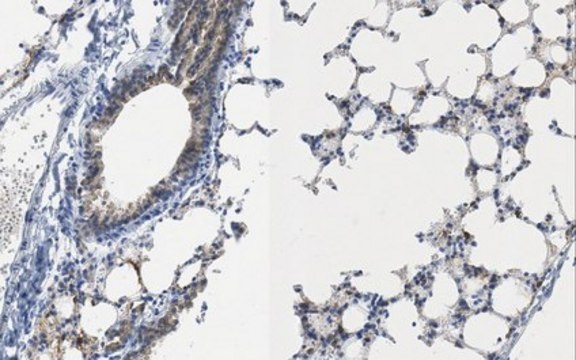 Anti-Cytokeratin 19 Antibody, clone TROMA-3 clone TROMA-3, from rat