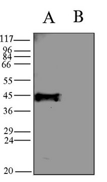 Anti-Potassium Channel GIRK2 Antibody Chemicon&#174;, from rabbit