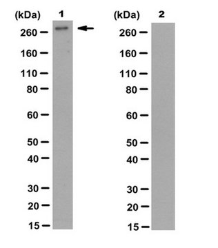 Anti-phospho-Filamin-A (Ser2152) Antibody, clone PS2 clone PS2, from mouse