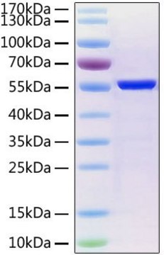 Recombinant 2019-nCoV Nucleocapsid Protein with His tag