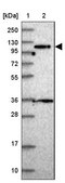 Anti-PPP6R1 antibody produced in rabbit Prestige Antibodies® Powered by Atlas Antibodies, affinity isolated antibody, buffered aqueous glycerol solution