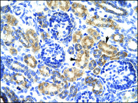 Anti-P2RX7 antibody produced in rabbit IgG fraction of antiserum