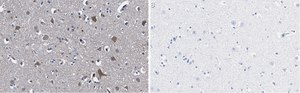 Anti-Stathmin-2 Antibody, clone 1B3 ZooMAb® Rabbit Monoclonal recombinant, expressed in HEK 293 cells