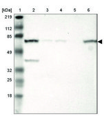 Anti-METTL3 antibody produced in rabbit Prestige Antibodies® Powered by Atlas Antibodies, affinity isolated antibody, buffered aqueous glycerol solution