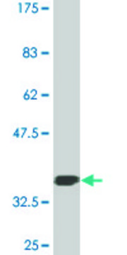 Monoclonal Anti-GLS, (C-terminal) antibody produced in mouse clone 6H1, purified immunoglobulin, buffered aqueous solution