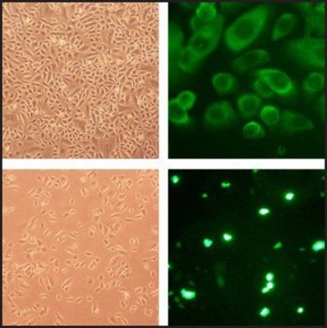 Human Tracheal Epithelial Cells: HTEpC, adult