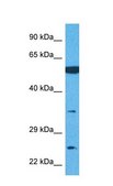 Anti-TMEM158 antibody produced in rabbit affinity isolated antibody