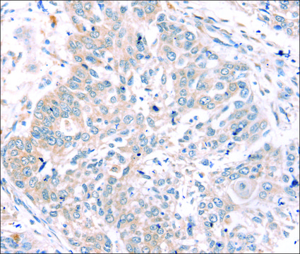 抗-ROR1 affinity isolated antibody