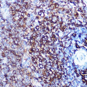 Anti-HLA-DQA1 antibody produced in rabbit