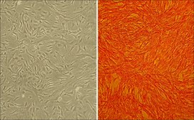 Bovine Pulmonary Artery Smooth Muscle Cells: BPASMC (Cryovial)