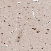 Anti-TMEM65 antibody produced in rabbit Prestige Antibodies® Powered by Atlas Antibodies, affinity isolated antibody, buffered aqueous glycerol solution