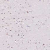 Anti-TBX15 antibody produced in rabbit Prestige Antibodies® Powered by Atlas Antibodies, affinity isolated antibody, buffered aqueous glycerol solution