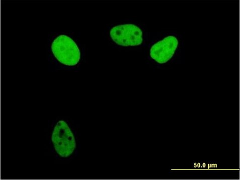 Anti-RPA1 antibody produced in mouse purified immunoglobulin, buffered aqueous solution