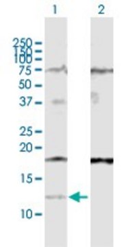 Anti-IFI27 antibody produced in rabbit purified immunoglobulin, buffered aqueous solution