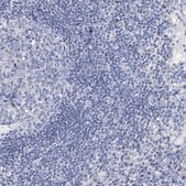 Anti-ANO1 antibody produced in rabbit Prestige Antibodies® Powered by Atlas Antibodies, affinity isolated antibody, buffered aqueous glycerol solution