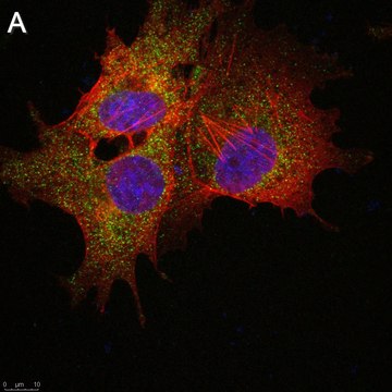 Anti-SLC19A1 Antibody, clone 2E11 ZooMAb&#174; Rabbit Monoclonal recombinant, expressed in HEK 293 cells