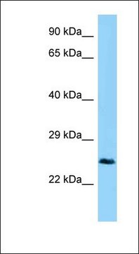 Anti-CTHRC1 antibody produced in rabbit affinity isolated antibody