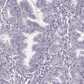 Anti-SPA17 antibody produced in rabbit Prestige Antibodies® Powered by Atlas Antibodies, affinity isolated antibody, buffered aqueous glycerol solution