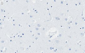 Anti-Presenilin-1 Antibody, clone 2O13 ZooMAb® Rabbit Monoclonal recombinant, expressed in HEK 293 cells