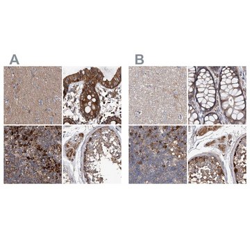 Anti-ASCC3 antibody produced in rabbit Prestige Antibodies&#174; Powered by Atlas Antibodies, affinity isolated antibody, buffered aqueous glycerol solution, ab3