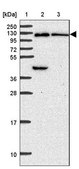 Anti-OSBPL7 antibody produced in rabbit Prestige Antibodies® Powered by Atlas Antibodies, affinity isolated antibody, buffered aqueous glycerol solution
