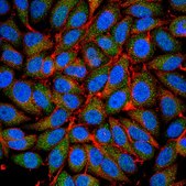 Anti-ICAT Antibody from rabbit, purified by affinity chromatography