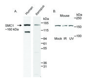Rabbit anti-SMC1 Antibody, Affinity Purified