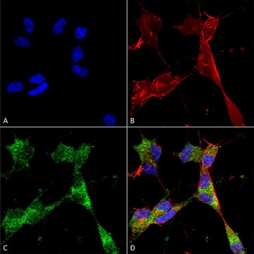 抗-Ataxin 1单克隆抗体 小鼠抗 clone S76-8, purified immunoglobulin