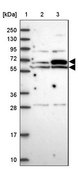 Anti-EHD2 antibody produced in rabbit Prestige Antibodies® Powered by Atlas Antibodies, affinity isolated antibody, buffered aqueous glycerol solution