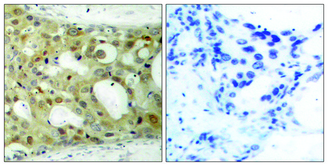 Anti-BCL-2 antibody produced in rabbit affinity isolated antibody