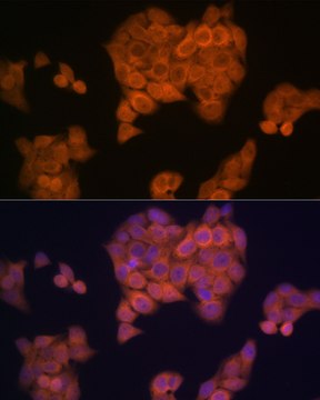 Anti-PMP70/ABCD3 Antibody, clone 3V4K3, Rabbit Monoclonal