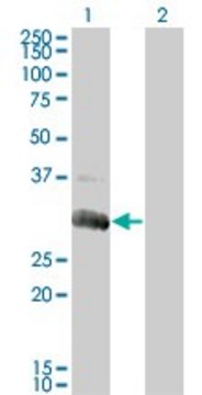 Monoclonal Anti-DGUOK antibody produced in mouse clone 3E9, purified immunoglobulin, buffered aqueous solution