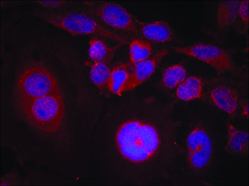 Anti-phospho-STAT3 (pSer727) antibody produced in rabbit affinity isolated antibody
