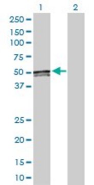 Anti-ACAA1 antibody produced in rabbit purified immunoglobulin, buffered aqueous solution