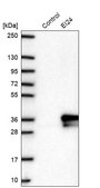Anti-EI24 antibody produced in rabbit Prestige Antibodies® Powered by Atlas Antibodies, affinity isolated antibody, buffered aqueous glycerol solution