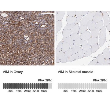 抗-VIM 兔抗 Prestige Antibodies&#174; Powered by Atlas Antibodies, affinity isolated antibody, buffered aqueous glycerol solution