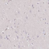 Anti-TNFRSF10A antibody produced in rabbit Prestige Antibodies® Powered by Atlas Antibodies, affinity isolated antibody, buffered aqueous glycerol solution