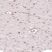 Monoclonal Anti-Klf2 Antibody Produced In Mouse Prestige Antibodies® Powered by Atlas Antibodies, clone CL14502, affinity isolated antibody, buffered aqueous glycerol solution