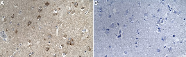 Anti-Neurexin-1-&#946; Antibody, clone 1F14 ZooMAb&#174; Rabbit Monoclonal recombinant, expressed in HEK 293 cells