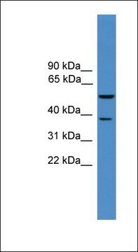 Anti-BACE1 antibody produced in rabbit affinity isolated antibody