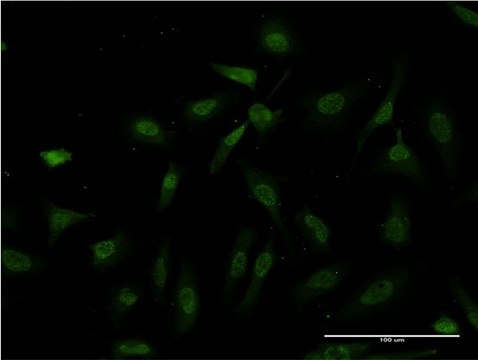 ANTI-IKBKB antibody produced in mouse clone 3C12, purified immunoglobulin, buffered aqueous solution