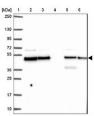 Anti-DNAJA2 antibody produced in rabbit Prestige Antibodies® Powered by Atlas Antibodies, affinity isolated antibody, buffered aqueous glycerol solution