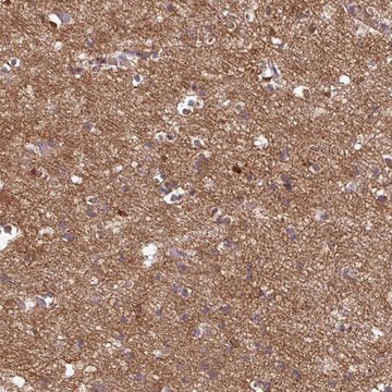 Anti-GABARAPL1 antibody produced in rabbit Prestige Antibodies&#174; Powered by Atlas Antibodies, affinity isolated antibody, buffered aqueous glycerol solution