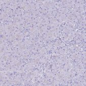 Anti-TPPP3 antibody produced in rabbit Prestige Antibodies® Powered by Atlas Antibodies, affinity isolated antibody, buffered aqueous glycerol solution