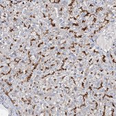 Anti-GUSB antibody produced in rabbit Prestige Antibodies® Powered by Atlas Antibodies, affinity isolated antibody, buffered aqueous glycerol solution