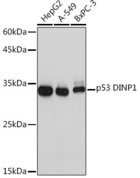 Anti-p53 DINP1 Antibody, clone 9Y6Z7, Rabbit Monoclonal